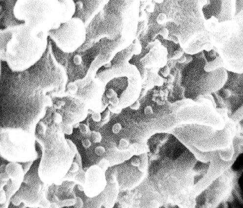 Представитель Семейства Metaviridae